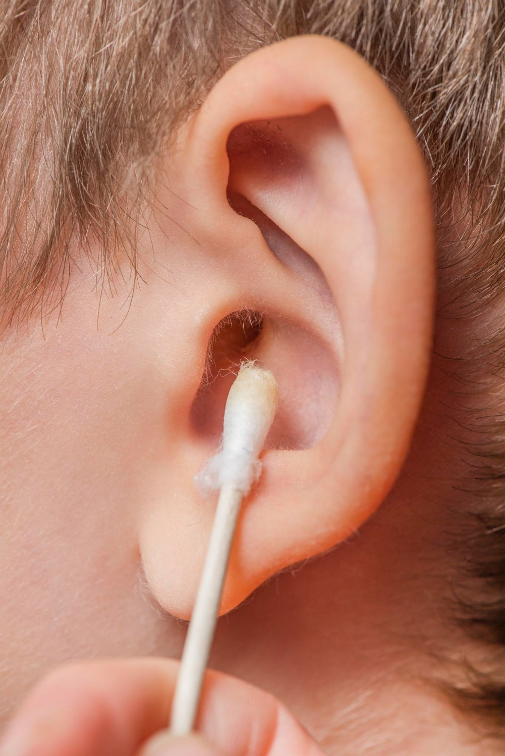 Achieving Optimal Ear Care with the Ear Wax Removal Kit Barnet Ear Care
